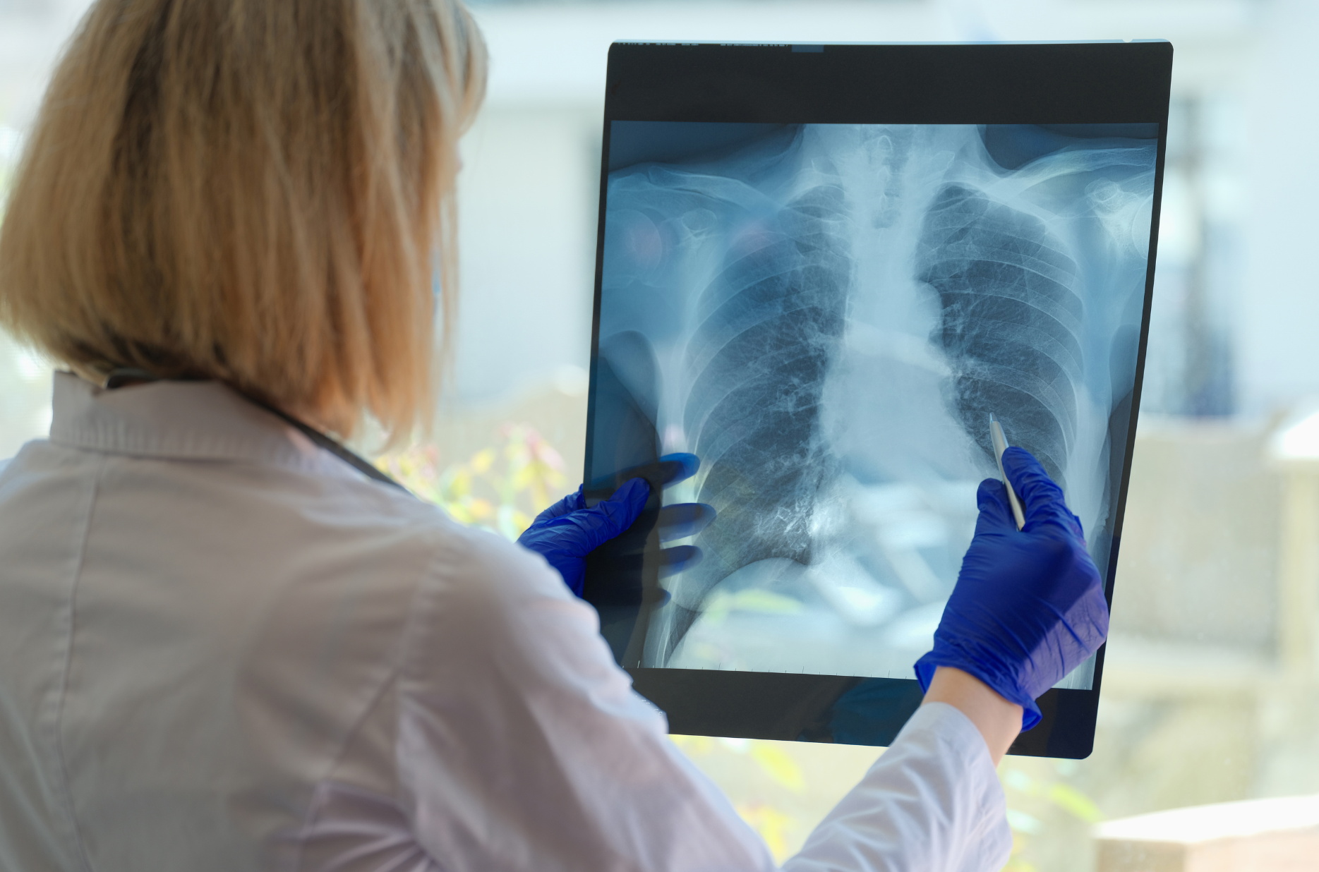 Asbestos Awareness Blog - Treatment breakthrough